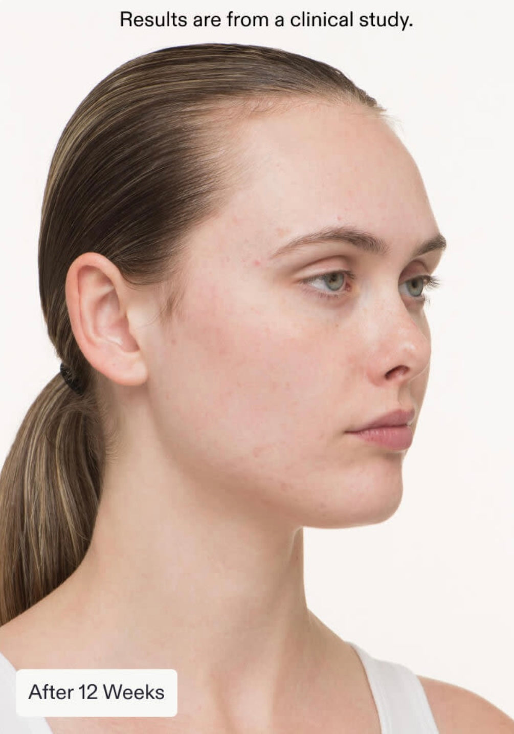 Nutrafol Clear Skin Nutraceutical - 3 Month Supply