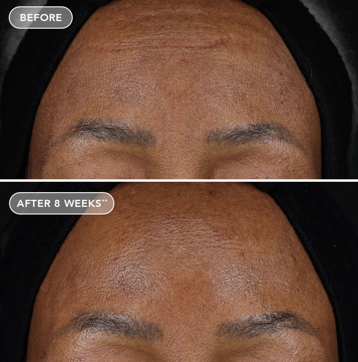 IMAGE Ageless+ Retinol Treatment Crème 1.2%