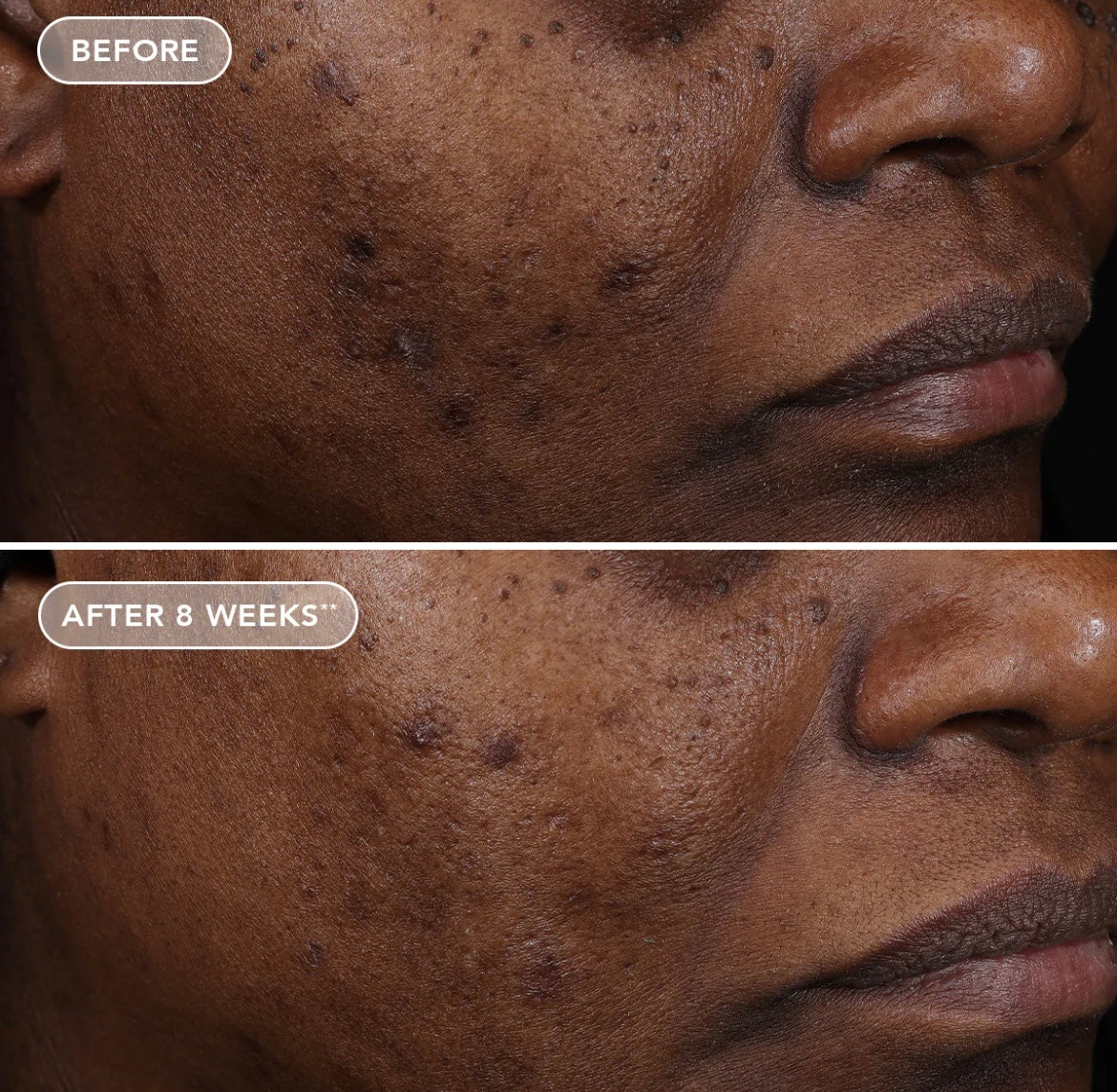 IMAGE Ageless+ Retinol Treatment Crème 1.2%