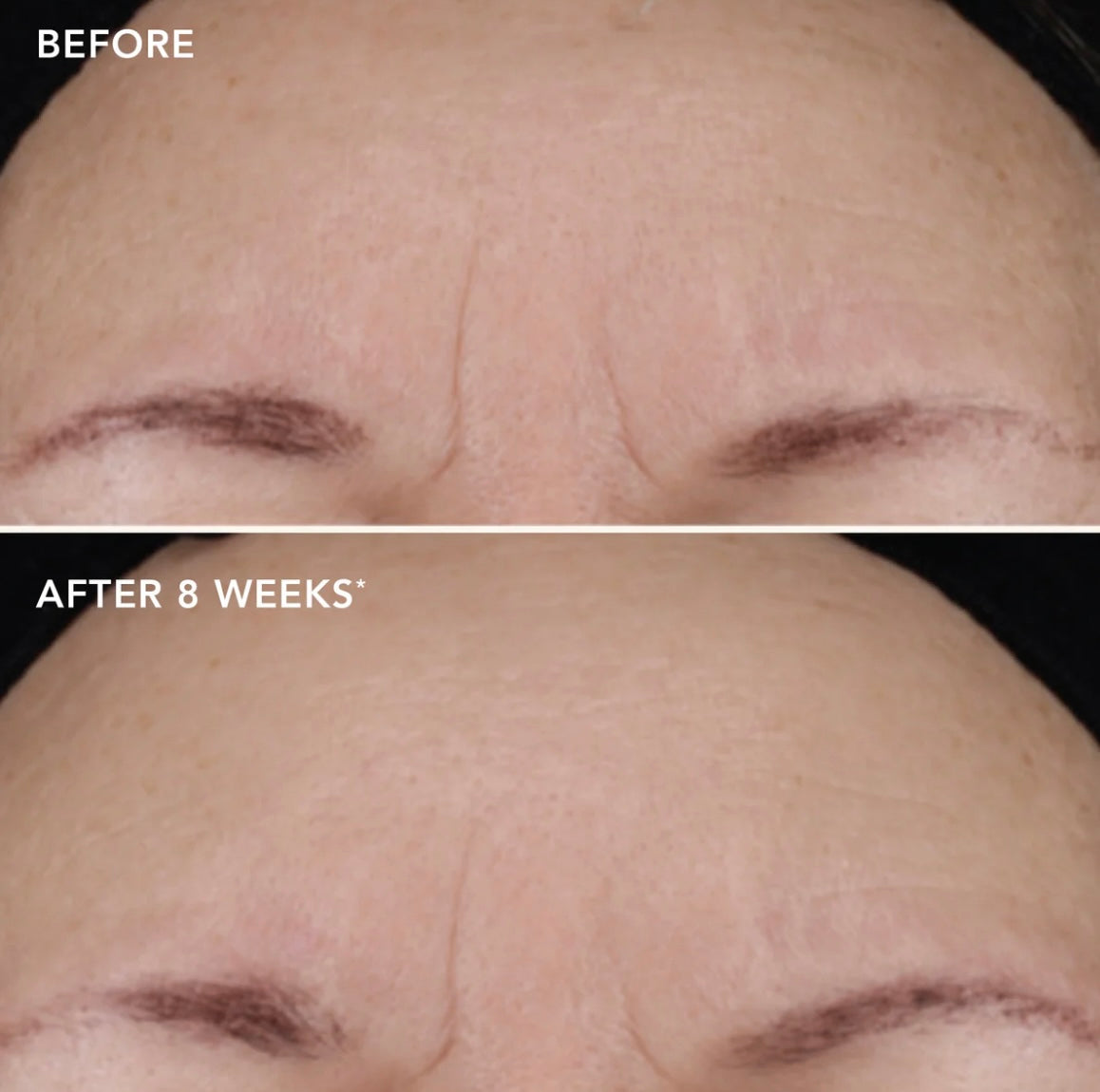 IMAGE Ageless+ Retinol Treatment Crème 1.2%