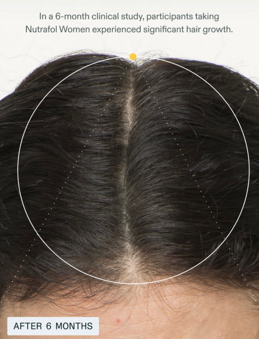 Nutrafol Women’s Hair Growth Supplement 3 Month Supply